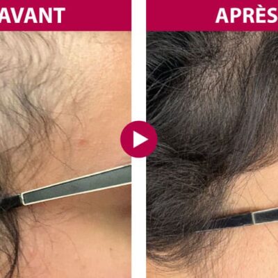 Guinot Hair summum mpterims